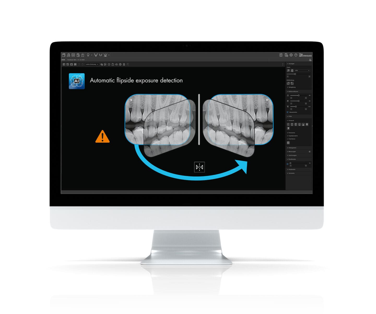 exposure-detection-AT_VisionX