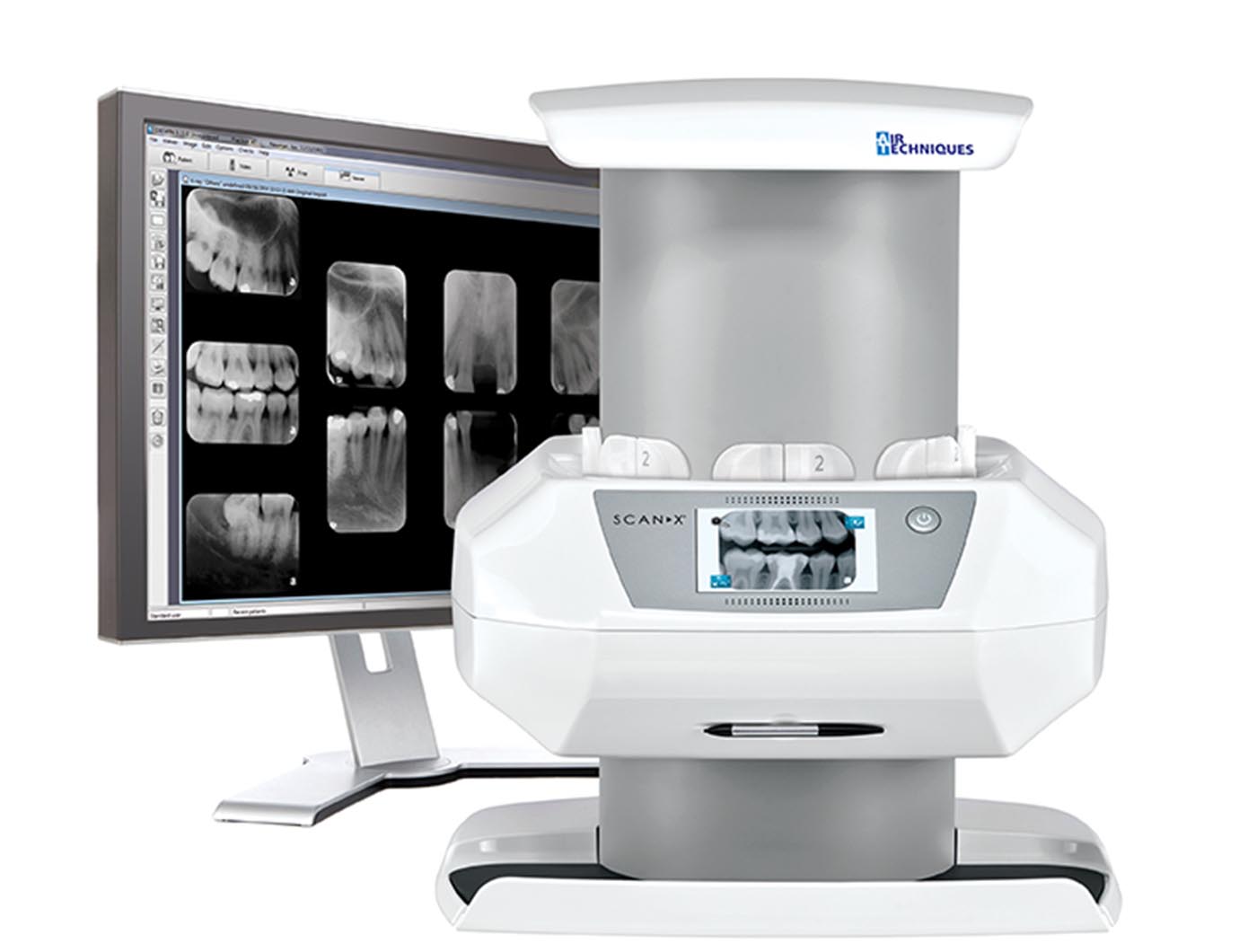 ScanX Intraoral View