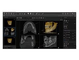 VisionXImplantSoftware